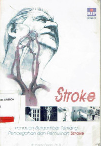 Image of Stroke